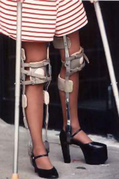 Dating disabled girls leg braces. 