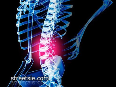 Incomplete vs Complete Spinal Cord Injury