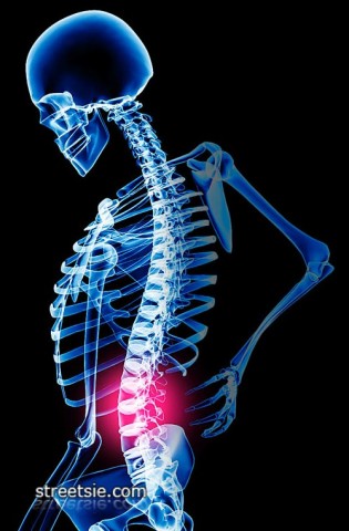 Chronic Spinal Pain
