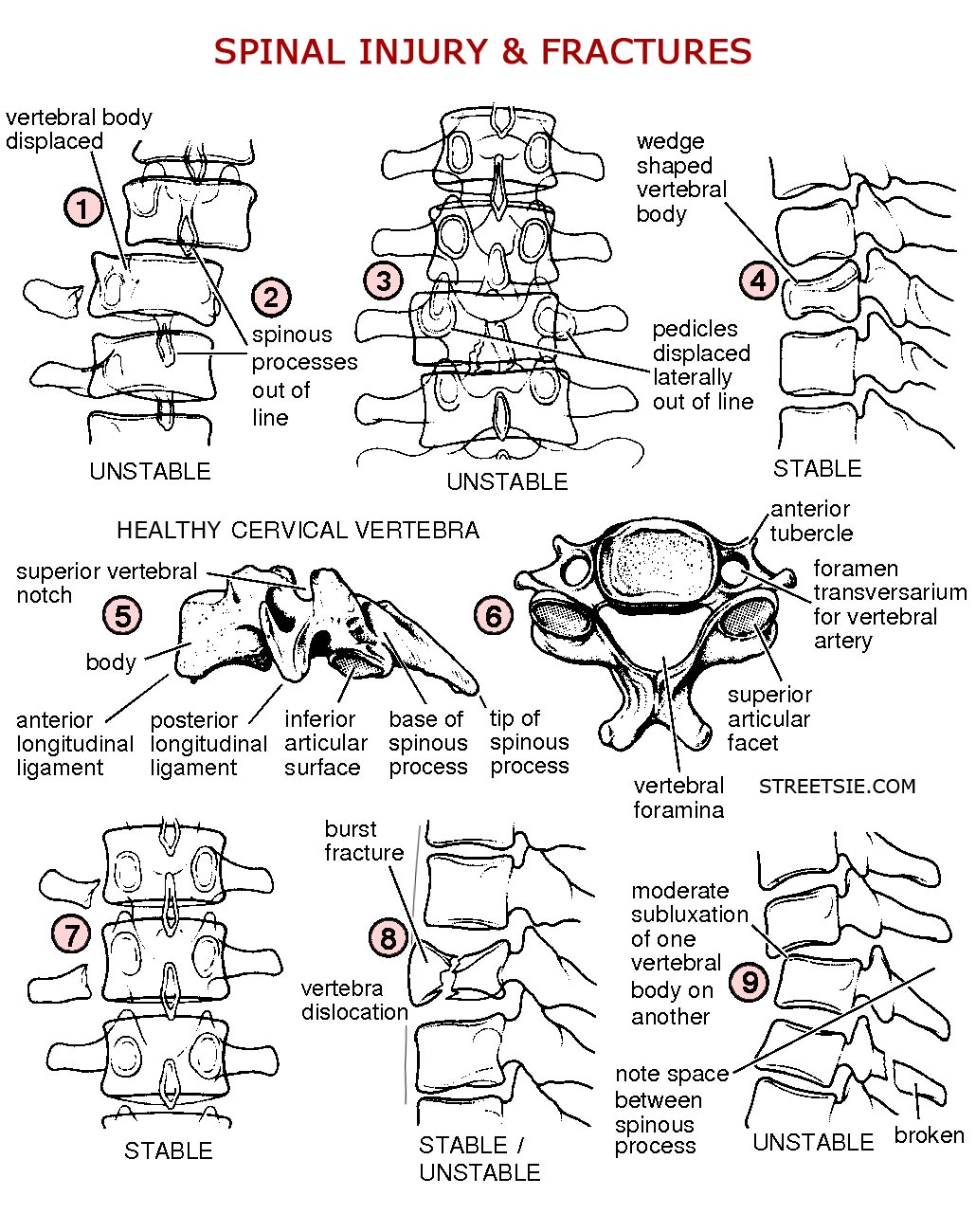 Spinal Cord Injury Radiology X-rays